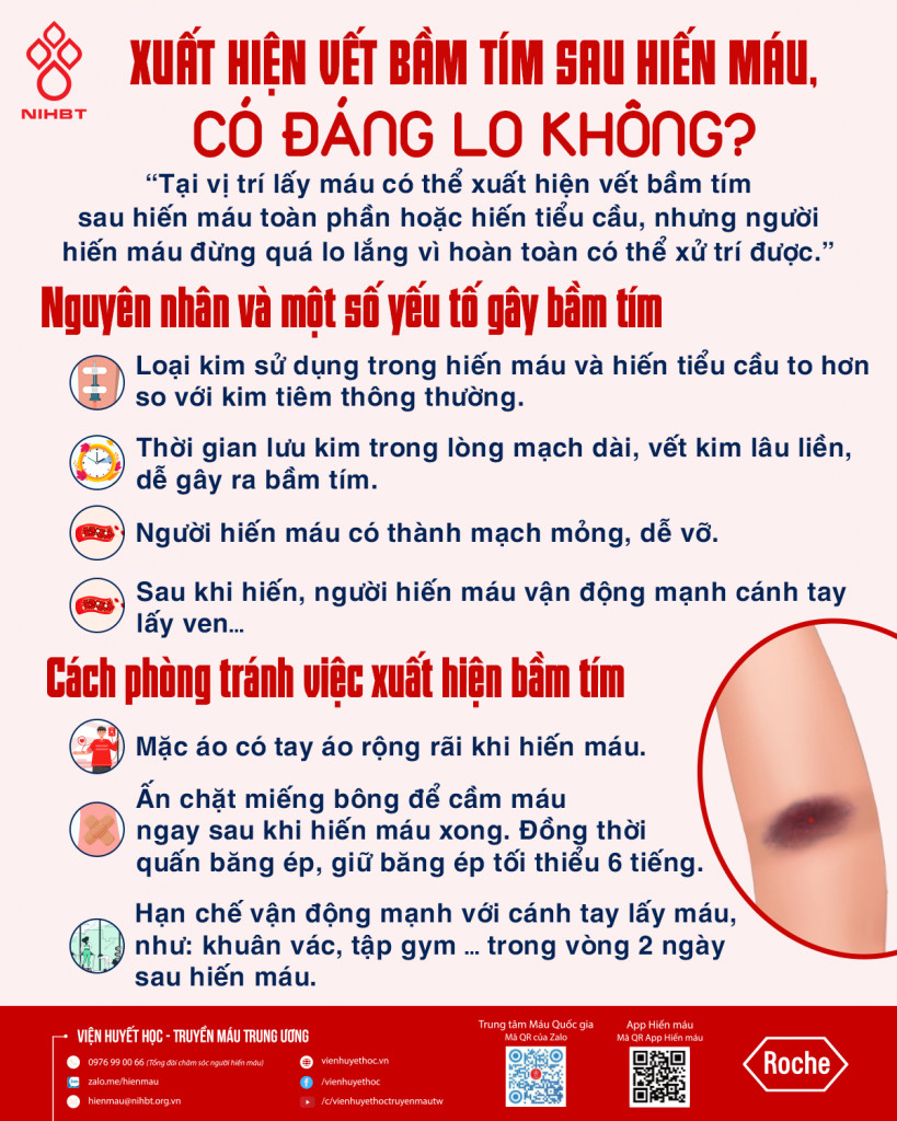 Minh họa các bước phòng tránh vết bầm tím ở vị trí lấy máu trên cánh tay