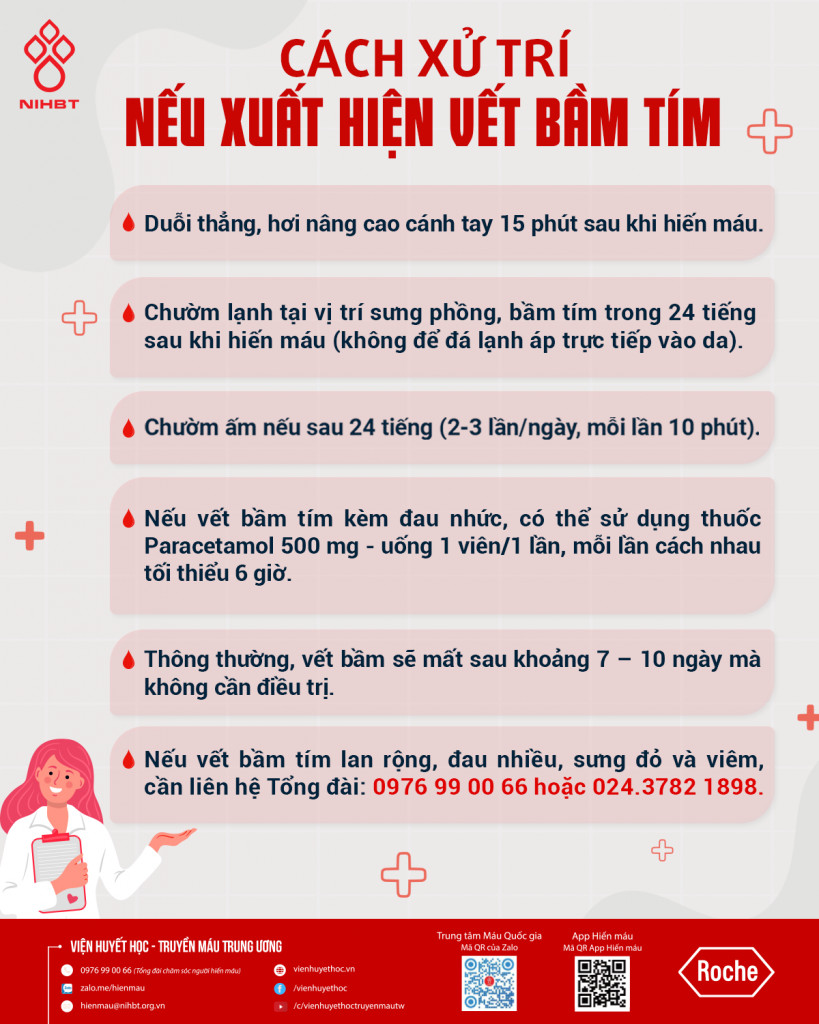Hướng dẫn cách chườm và xử lý vết bầm tím do vỡ ven sau khi hiến máu