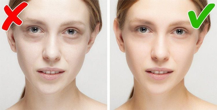 Hình ảnh một người có làn da xanh xao, nhợt nhạt, biểu hiện của thiếu máu do thiếu vitamin B12 nghiêm trọng