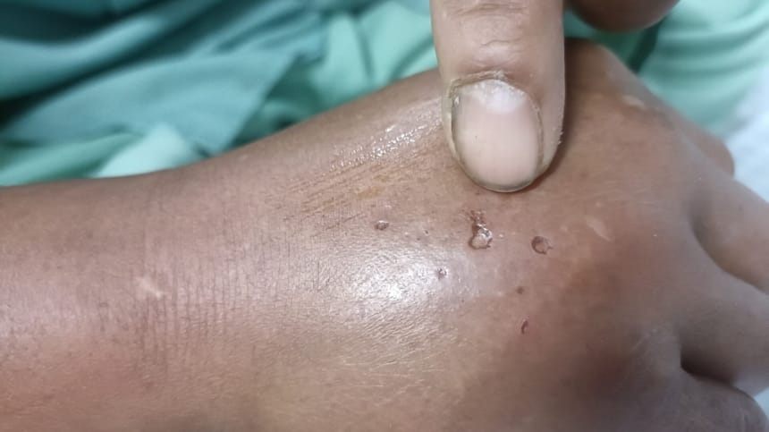 Mơ thấy rắn cắn người trong gia đình mang điềm gì?