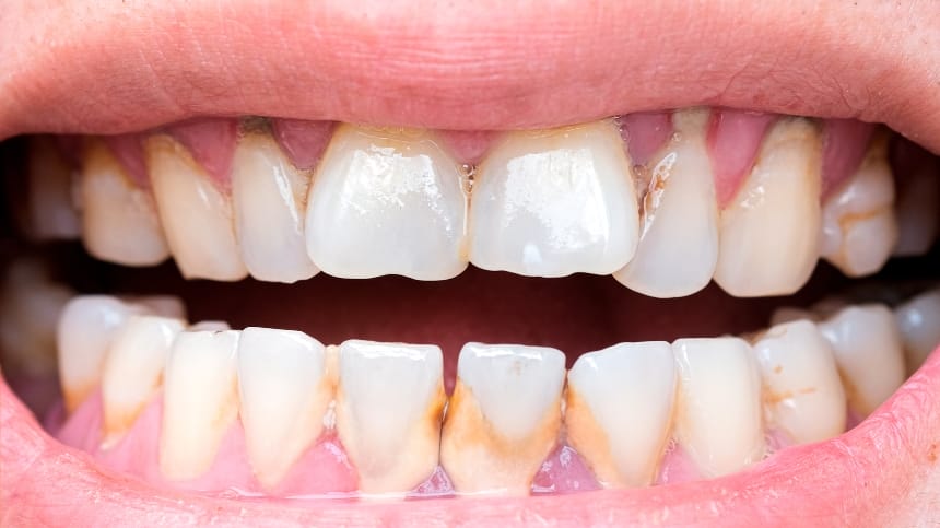 Đặt cược số may mắn đến từ giấc mộng