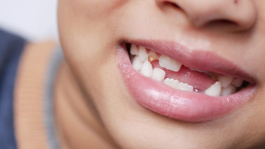 Giải mã 9 giấc mơ răng lung lay hay thấy