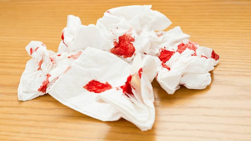 Giải mã giấc mơ thấy người thân chảy máu