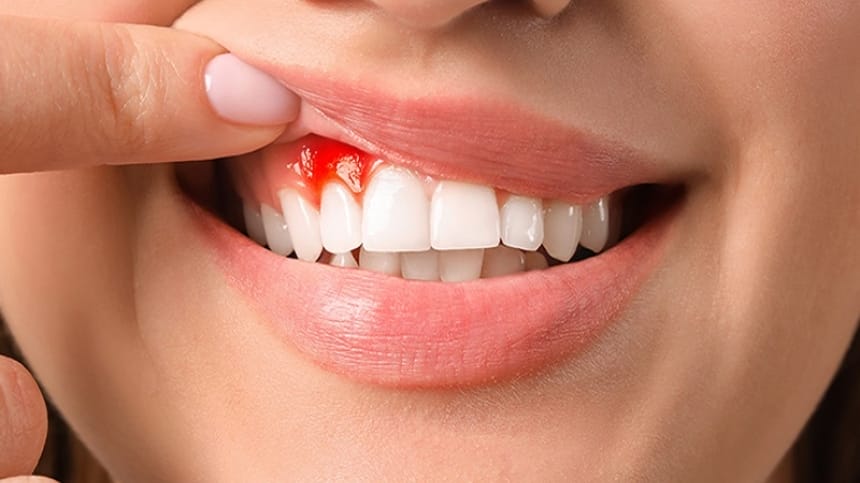 Mơ thấy mình bị chảy máu chân răng