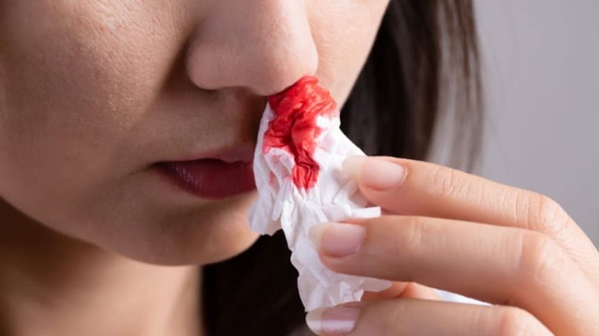 Mơ thấy người thân chảy máu cam