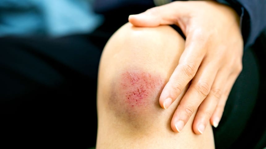 Mơ thấy người thân chảy máu chân