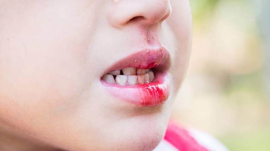 Mơ thấy người thân chảy máu mồm