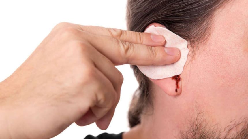 Ngủ mơ thấy mình bị chảy máu mang điềm gì?