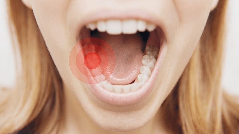 Mơ thấy răng sâu: Điềm báo tâm lý hay tín hiệu tâm linh?